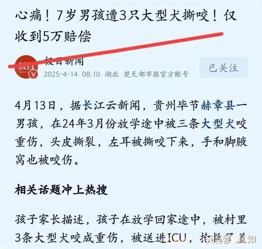 7岁男孩遭3只犬撕咬,7岁男孩遭3只犬撕咬怎么办